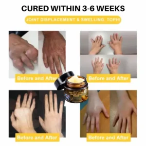 NovaRX® Pain Relief & Bone Healing Cream with Bee Venom image NovaRX® Pain Relief & Bone Healing Cream with Bee Venom