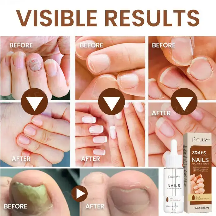 Piguiay® Nails Repairing Serum image Piguiay® Nails Repairing Serum