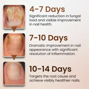 Piguiay® Nails Repairing Serum image Piguiay® Nails Repairing Serum