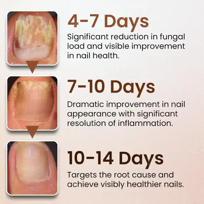 Piguiay® Nails Repairing Serum image Piguiay® Nails Repairing Serum