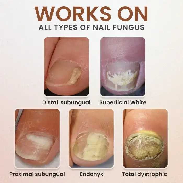 Piguiay® Nails Repairing Serum image Piguiay® Nails Repairing Serum