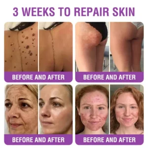 Furzero® Queen Nectar Peptide + Bakuchiol Skin Restoration Cream