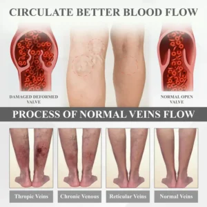 RICPIND® RedHeat EMS EdemaDrain Leg Massager