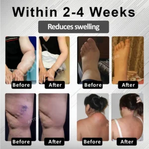 RICPIND® RedHeat EMS EdemaDrain Leg Massager