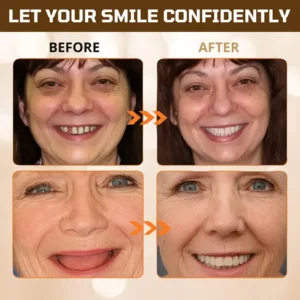 Cvreoz® Adsorptive denture image Cvreoz® Adsorptive denture