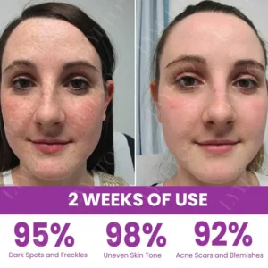 TAILEDEN® MelantraX Advanced Brightening Essence ACE