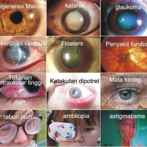 Japan Vision Drops — Rapidly Heals All Eye Conditions & Restores Vision