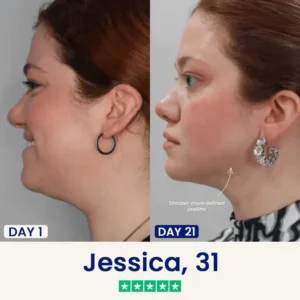 LUHAKA® Camellia Deep Collagen V Lifting Gel Mask