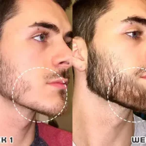 Put an end to hair loss with LOVILDS™ Rollerball Serum image Put an end to hair loss with LOVILDS™ Rollerball Serum