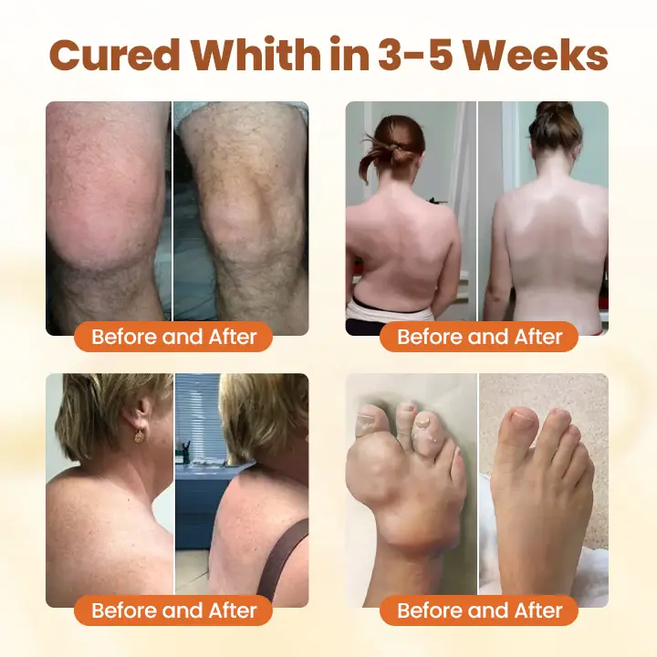 Caselast® Premium Curcumin Pain Relief Gel image Caselast® Premium Curcumin Pain Relief Gel