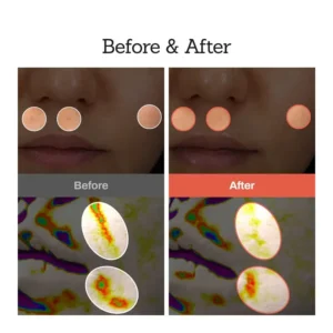 NESLEMY™Retinal Skin Booster Serum