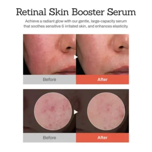 NESLEMY™Retinal Skin Booster Serum