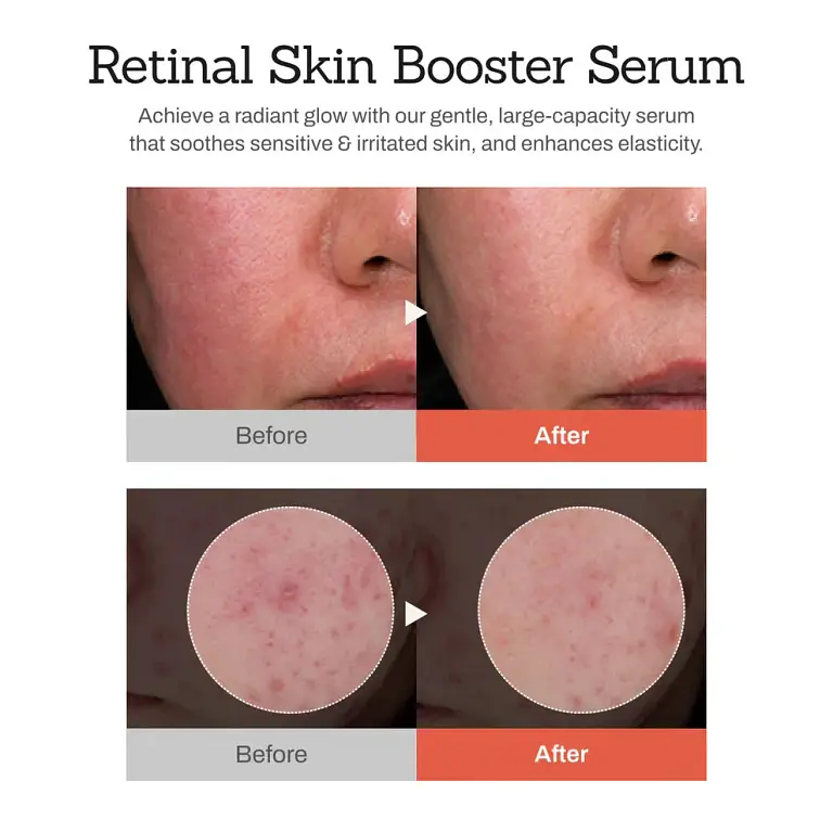 NESLEMY™Retinal Skin Booster Serum