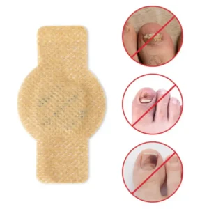 Health Care Patches – Repair and Strengthen Weak Nails