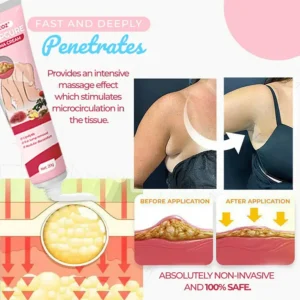 CVREOZ® LumpCure Lipoma Cream