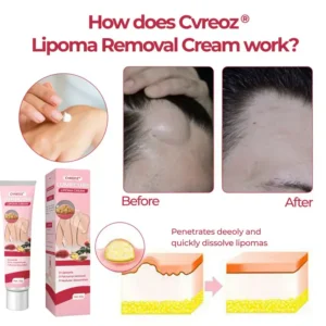 CVREOZ® LumpCure Lipoma Cream