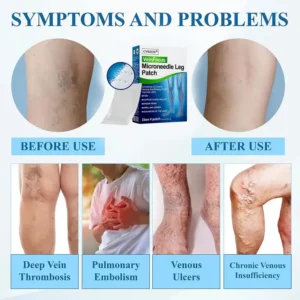 Cvreoz® VeinFocus Microneedle Leg Patch