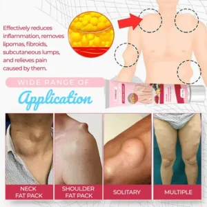 CVREOZ® LumpCure Lipoma Cream