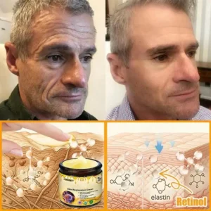 Laozik™ Skin Restoration Cream