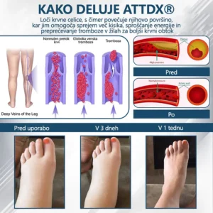 ATTDX® Black Cumin – herbal cream to soothe swelling