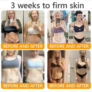 AWZLOVE® Bee Venom Comprehensive Cream