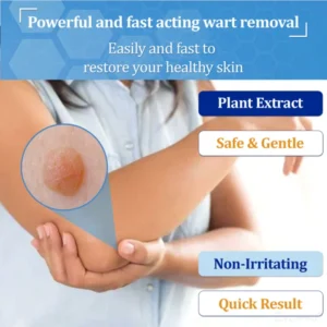 Zvoevo® BeeDerm RX Cream, Painless, Targeted Treatment for Warts 8 Zvoevo® BeeDerm RX Cream, Painless, Targeted Treatment for Warts