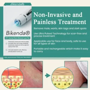 Bikenda® HPV Genital Warts Removal Laser Pen