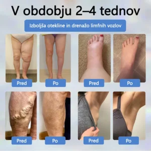 ATTDX® Black Cumin – herbal cream to soothe swelling