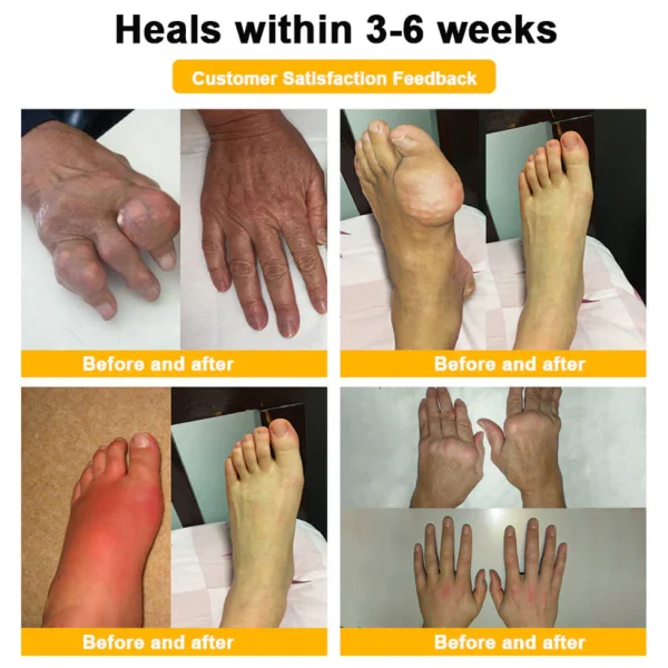 Yagoo™ Botulinum & Bee Essence Pain Relief Bone Healing Cream