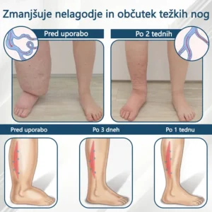 ATTDX® Black Cumin – herbal cream to soothe swelling