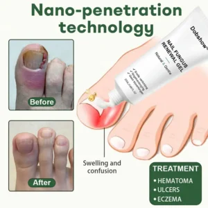 Dobshow® Nail Fungus Renewal Gel
