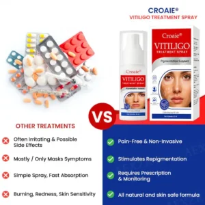 Croaie® Vitiligo Treatment Spray – No allergies