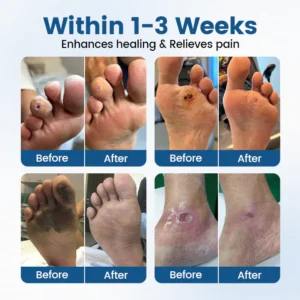 TAILEDEN® AngioVita Diabetic Care Spray