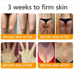 AWZLOVE® Bee Venom Comprehensive Cream