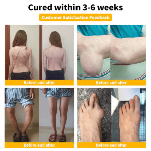 Zentheca BeeThera | Bee Venom-Infused Relief for Bones & Joints