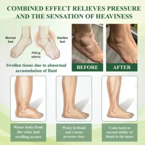 ATTDX® Edema Drain Duo Therapy Roller Cream