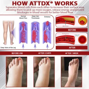 ATTDX® Advanced CVI Edema Therapy Cream