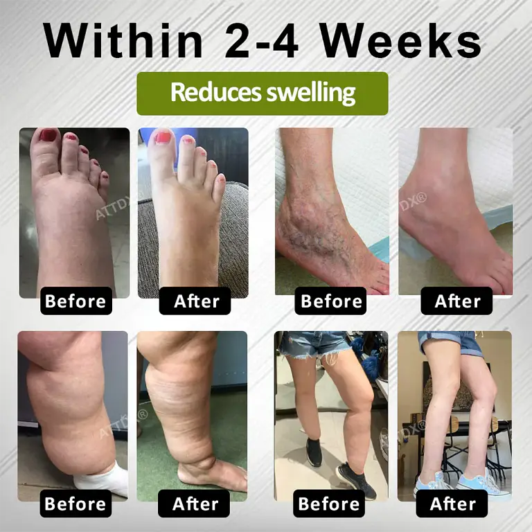 ATTDX® EdemaFree Flow Drain Massage Cream