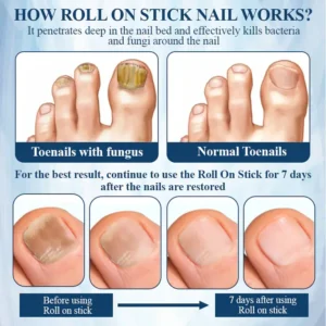 ATTDX® FungaGuard Botanica Roll On Stick