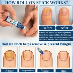 ATTDX® FungaGuard Botanica Roll On Stick