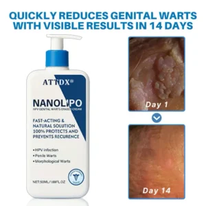 ATTDX® NanoLipo HPV Genital Warts Eraser Cream