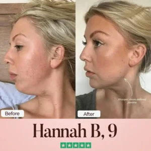 ChérieGlow SculptFix™ Kit