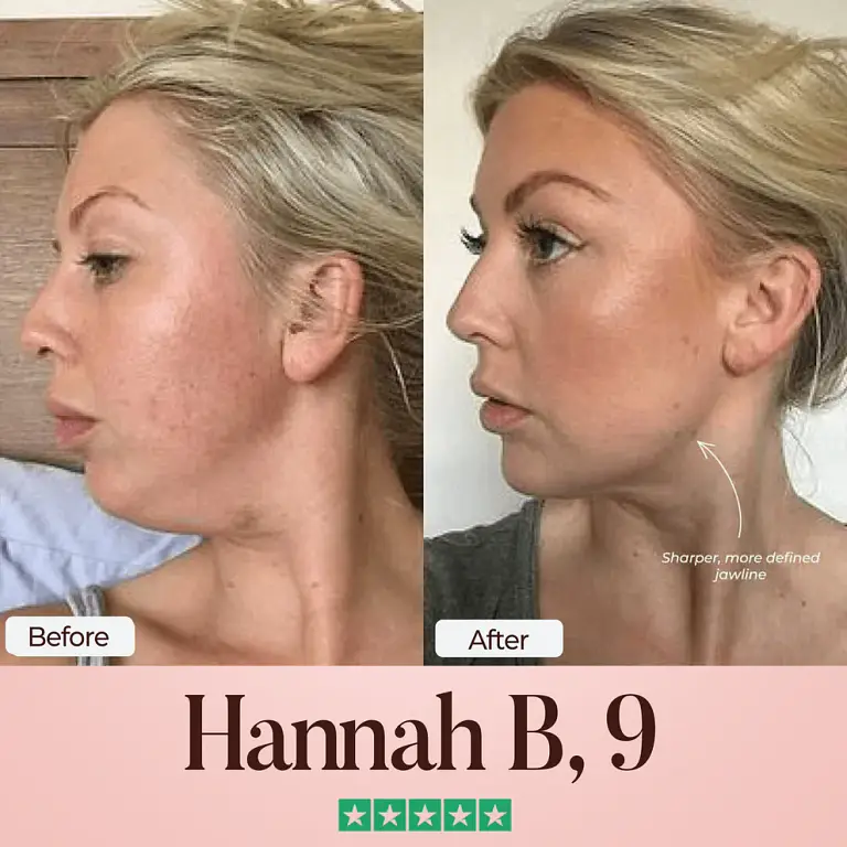 ChérieGlow SculptFix™ Kit