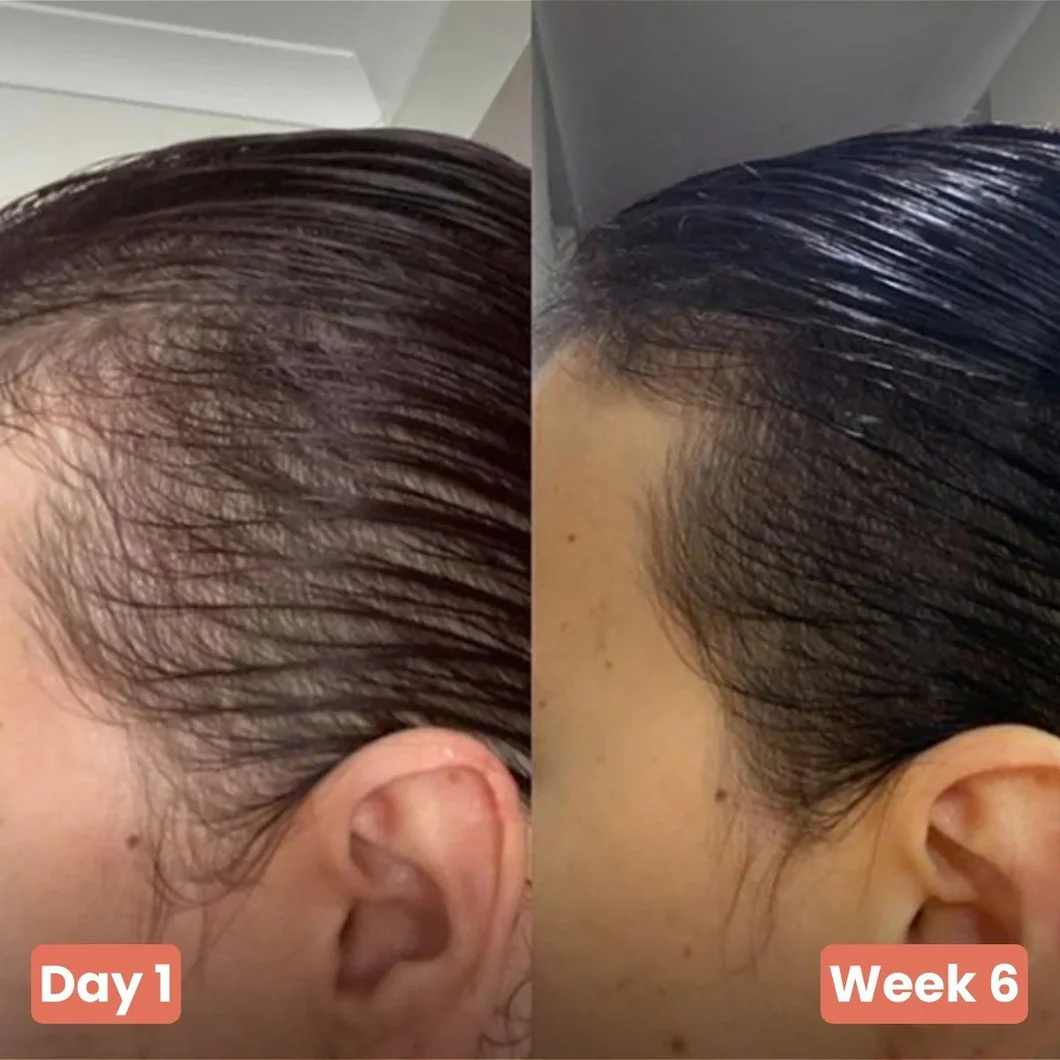 GrowthlyCo Pumpkin Seed Oil Softgels