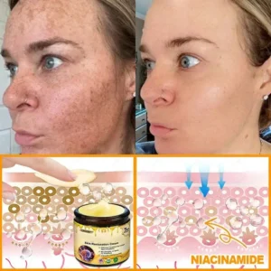 Laozik™ Skin Restoration Cream