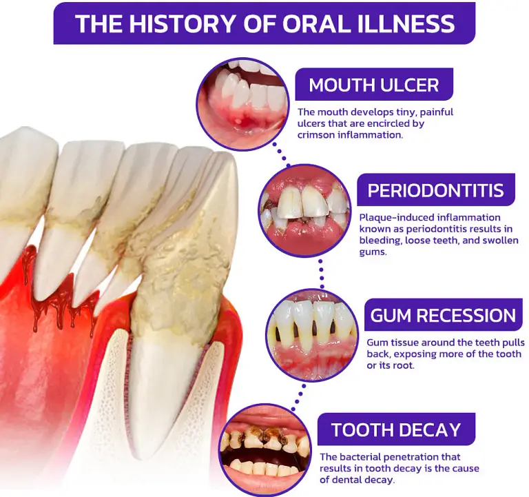 Cougex® VioGloss Bee Venom Dental Therapy Oral Power