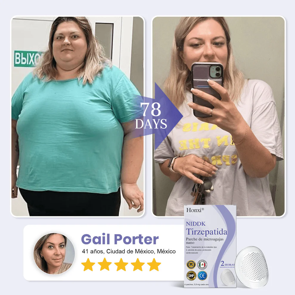 Honxi NIDDK-Tirzepatide Nano Microneedle Patch - Image 5