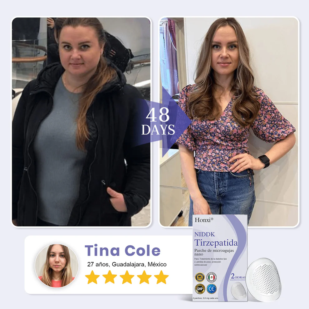 Honxi NIDDK-Tirzepatide Nano Microneedle Patch - Image 4