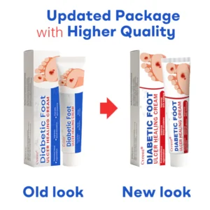 Cvreoz® Diabetic Foot Ulcer Healing Cream