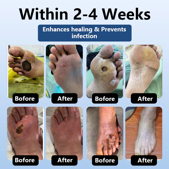 DiabeHeal™ Diabetic Skin Healing Cream